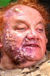 Baron Harkonnen